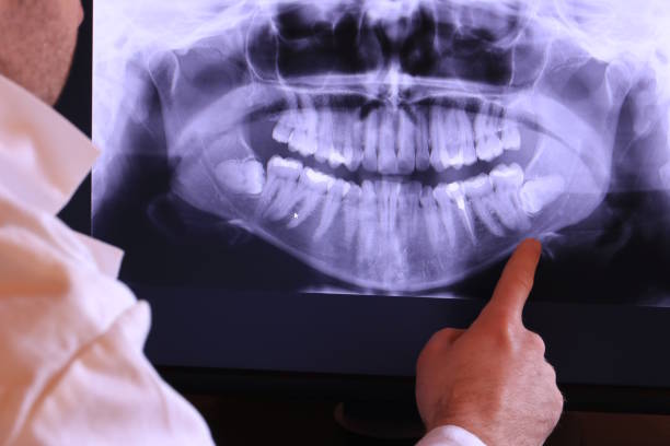 Best Knocked-Out Tooth Emergency  in Fairview, CA